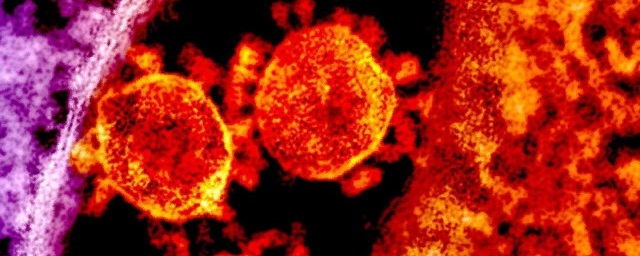 Еще трое скончались в Волгоградской области от коронавируса